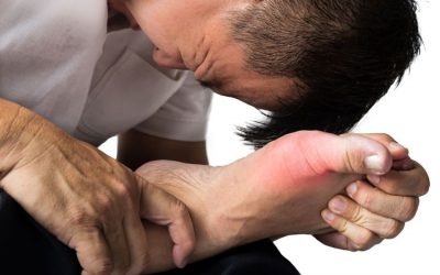 Penyakit Asam Urat, Penyebab, Gejala, dan mengatasinya